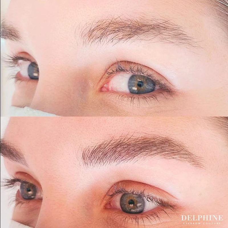 Static before/after